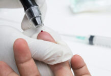 Teste rápido de dengue passa a integrar tabela do SUS