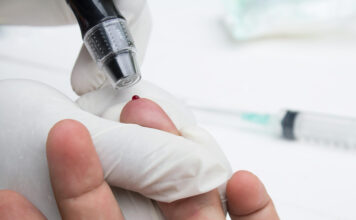 Teste rápido de dengue passa a integrar tabela do SUS