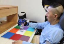 China aprova primeiro chip cerebral para uso comercial do mundo; tecnologia atende pacientes com paralisia